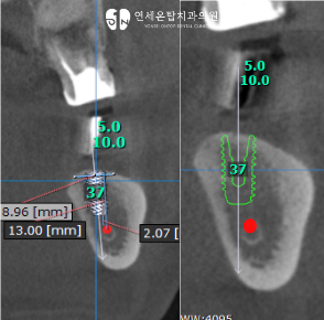 5.png
